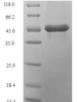Zea mays (Maize) Sucrose synthase 1 (SH-1), partial Recombinant Protein - BioCrest Sci