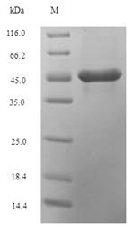 Zea mays (Maize) Sucrose synthase 1 (SH-1), partial Recombinant Protein, Zea mays (Maize), E.coli, N-terminal 6xHis-SUMO-tagged, 44.8 kDa, purity >≥ 90% as determined by SDS-PAGE.