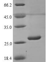 Human Butyrophilin subfamily 3 member A1 (BTN3A1), partial Recombinant Protein, N-His - BioCrest Sci