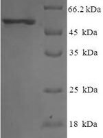 Human Eukaryotic translation initiation factor 3 subunit G (EIF3G) Recombinant Protein - BioCrest Sci