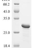 Human Osteopontin (SPP1), partial Recombinant Protein, N-His - BioCrest Sci