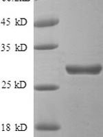 Human Beta-adrenergic receptor kinase 1 (GRK2), partial Recombinant Protein - BioCrest Sci