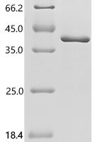 Human Complement C1q tumor necrosis factor-related protein 1 (C1QTNF1) Recombinant Protein, C-His - BioCrest Sci
