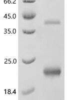 Human Metallothionein-2 (MT2A), partial Recombinant Protein, N-His/C-His - BioCrest Sci