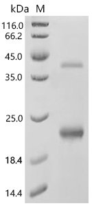 Human Metallothionein-2 (MT2A), partial Recombinant Protein, N-His/C-His, Homo sapiens (Human), E.coli, N-terminal 6xHis-tagged and C-terminal 6xHis-tagged, 15.9 kDa, purity >≥ 95% as determined by SDS-PAGE.
