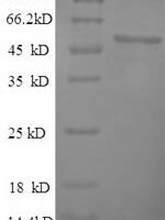 Human herpesvirus 1 Thymidine kinase (TK) Recombinant Protein, N-His - BioCrest Sci