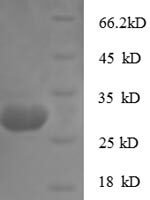 Rabbit Cathepsin K (Ctsk) Recombinant Protein - BioCrest Sci