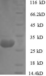 Rabbit Cathepsin K (Ctsk) Recombinant Protein, Oryctolagus cuniculus (Rabbit), E.coli, N-terminal 6xHis-tagged, 27.6 kDa, purity >≥ 90% as determined by SDS-PAGE.