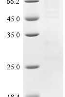 Mouse Semaphorin-3G (Sema3g) Recombinant Protein, N-His - BioCrest Sci