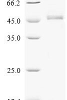 Human HLA class I histocompatibility antigen, alpha chain G (HLA-G) Recombinant Protein, N-His-SUMOstar - BioCrest Sci