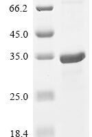 Human Cathepsin W (CTSW) Recombinant Protein - BioCrest Sci