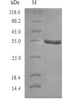Geobacillus stearothermophilus ATP-dependent DNA helicase PcrA (pcrA), partial Recombinant Protein - BioCrest Sci