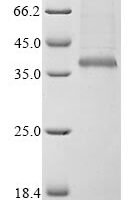 Bovine coronavirus Spike glycoprotein (S), partial Recombinant Protein, C-His, aa 314–634, strain LSU-94LSS-051, Mammalian cell - BioCrest Sci