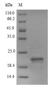 Mouse Lymphocyte antigen 6E (Ly6e) Recombinant Protein, N-His-B2M, Mus musculus (Mouse), E.coli, N-terminal 6xHis-B2M-tagged, 22.8 kDa, purity >≥ 90% as determined by SDS-PAGE.