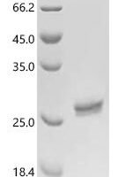 Human immunodeficiency virus type 1 group M subtype B Gag polyprotein (gag), partial Recombinant Protein, C-10His - BioCrest Sci