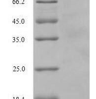 Human ATP-dependent translocase ABCB1 (ABCB1), partial Recombinant Protein - BioCrest Sci