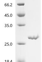 Abrus precatorius Abrin-d, partial Recombinant Protein - BioCrest Sci