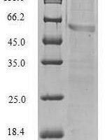 Human Vimentin (VIM) Recombinant Protein, N-His, aa 2–466, E.coli - BioCrest Sci