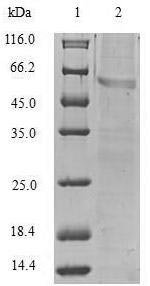 Human Vimentin (VIM) Recombinant Protein, N-His, aa 2–466, E.coli, Homo sapiens (Human), E.coli, N-terminal 6xHis-tagged, 57.5 kDa, purity >≥ 90% as determined by SDS-PAGE.
