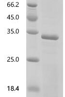 Mouse Mucolipin-1 (Mcoln1) , partial Recombinant Protein - BioCrest Sci