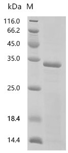 Mouse Mucolipin-1 (Mcoln1) , partial Recombinant Protein, Mus musculus (Mouse), E.coli, C-terminal 6xHis-tagged, 31.1 kDa, purity >≥ 85% as determined by SDS-PAGE.