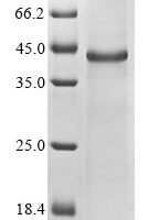 Mouse Cellular communication network factor 6 (Ccn6) Recombinant Protein, N-His - BioCrest Sci