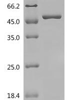Rat DNA polymerase beta (Polb) Recombinant Protein, C-His - BioCrest Sci