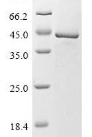 Human Lipoyltransferase 1, mitochondrial (LIPT1) Recombinant Protein, N-His - BioCrest Sci