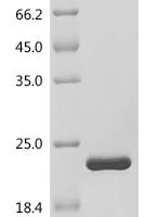 Human Fibroblast growth factor 1 (FGF1) Recombinant Protein, N-His, aa 16–155, E.coli - BioCrest Sci