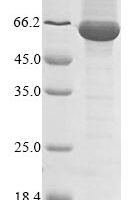 Turnip mosaic virus Polyprotein, partial Recombinant Protein - BioCrest Sci