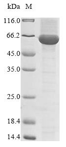 Turnip mosaic virus Polyprotein, partial Recombinant Protein, Turnip mosaic virus (strain Japanese) (TuMV), E.coli, N-terminal 10xHis-tagged and C-terminal Myc-tagged, 66.6 kDa, purity >≥ 85% as determined by SDS-PAGE.