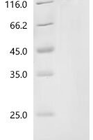 Rat Heat shock protein HSP 90-alpha (Hsp90aa1) Recombinant Protein, C-10His, aa 2–733, E.coli - BioCrest Sci