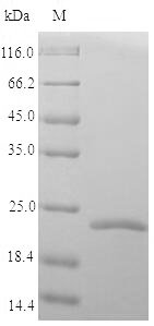 Marmota monax Tumor necrosis factor (TNF), partial Recombinant Protein, N-His, Marmota monax (Woodchuck), Yeast, N-terminal 6xHis-tagged, 21.7 kDa, purity >≥ 90% as determined by SDS-PAGE.