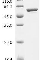 Escherichia coli Serine--tRNA ligase (serS) Recombinant Protein - BioCrest Sci