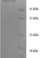 Human Transaldolase (TALDO1), partial Recombinant Protein - BioCrest Sci