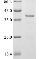 Mouse Twist-related protein 1 (Twist1) Recombinant Protein - BioCrest Sci