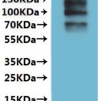 Dog Transient receptor potential cation channel subfamily V member 6 (TRPV6)-VLPs Recombinant Protein - BioCrest Sci