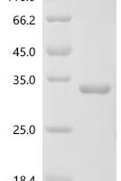 Escherichia coli Protein phosphatase CheZ (cheZ) Recombinant Protein - BioCrest Sci
