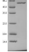 Mouse Alanine aminotransferase 1 (Gpt) Recombinant Protein - BioCrest Sci