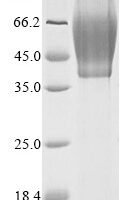 Vaccinia virus Protein OPG190 (OPG190), partial Recombinant Protein, N-His - BioCrest Sci