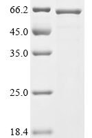 Mesocricetus auratus Neuropilin (Nrp1), partial Recombinant Protein - BioCrest Sci