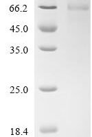 Human Vimentin (VIM) Recombinant Protein, C-His, aa 2–466, Mammalian cell - BioCrest Sci