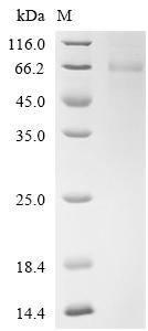 Human Vimentin (VIM) Recombinant Protein, C-His, aa 2–466, Mammalian cell, Mammalian cell, C-terminal 6xHis-tagged, 56.2 kDa, purity >≥ 90% as determined by SDS-PAGE.