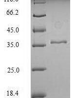 Human KeRatin, type I cytoskeletal 18 (KRT18), partial Recombinant Protein - BioCrest Sci