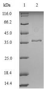 Human KeRatin, type I cytoskeletal 18 (KRT18), partial Recombinant Protein, Homo sapiens (Human), E.coli, N-terminal 6xHis-tagged, 38.0 kDa, purity >≥ 90% as determined by SDS-PAGE.