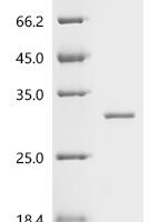 Mouse Ferritin heavy chain (Fth1) Recombinant Protein - BioCrest Sci