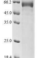 Rat Sclerostin (Sost) Recombinant Protein - BioCrest Sci