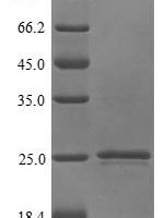 Human Prostaglandin E synthase 3 (PTGES3) Recombinant Protein, N-10His - BioCrest Sci