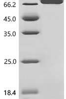 Human Phosphoglucomutase (PGM2) Recombinant Protein, C-His, aa 2–612, Yeast - BioCrest Sci