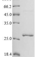 Reovirus type 3 Outer capsid protein lambda-2 (L2), partial Recombinant Protein, N-His - BioCrest Sci